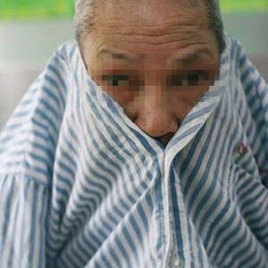 精神分裂症患者2