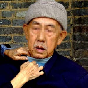 老年痴呆患者图片3