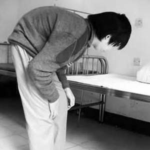 强直性脊柱炎晚期图片3