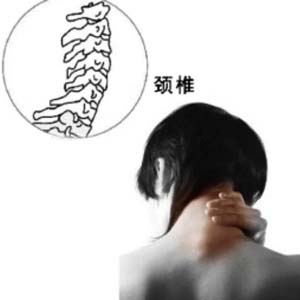 颈椎病图解8