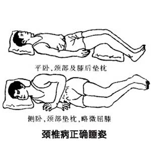 颈椎病正确睡姿图片1