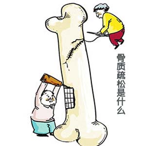 骨质疏松卡通