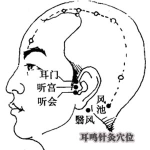 耳鸣针灸穴位图片7