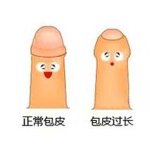 正常包皮图片7
